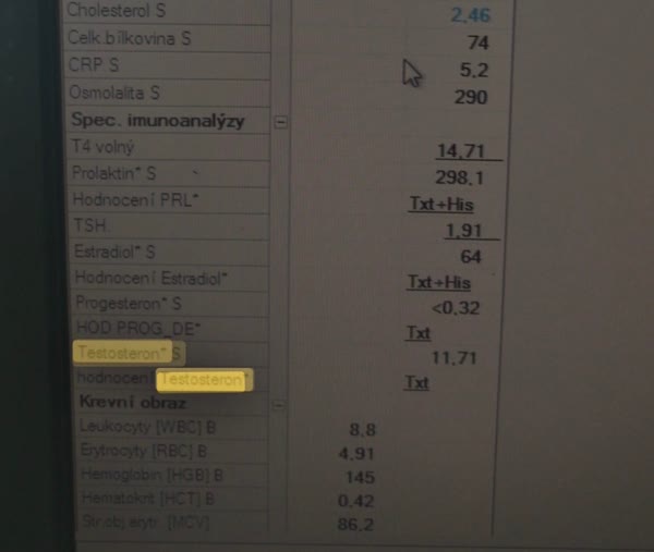 Krevní test před
